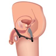 Picture of Epic Triple Stim Anal Plug and Cock Ring