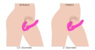 Picture of Worlds First Remote Control Inflatable Vibrating Silicone Ergo Fit Strapless Strap-On