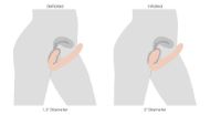 Picture of Remote Control Inflatable Vibrating Silicone Ergo Fit Strapless Strap-On