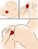 Picture of Bloomgasm Wild Violet 10X Silicone Clit Licking Stimulator - Red