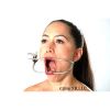 Picture of Jennings Dental Mouth Gag